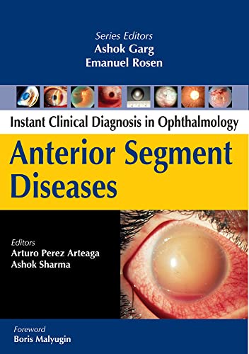 Beispielbild fr Anterior Segment Diseases (Instant Clinical Diagnosis in Ophthalmology) zum Verkauf von Books From California