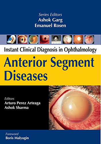9780071667265: Anterior Segment Diseases (Instant Clinical Diagnosis in Ophthalmology)
