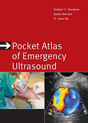 Pocket Atlas of Emergency Ultrasound (Atlas Series) (9780071668071) by Reardon Dr., Robert F.; Ma M.D., O. John; Mateer MD, James R.
