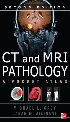 Imagen de archivo de CT & MRI Pathology: A Pocket Atlas, Second Edition a la venta por SecondSale