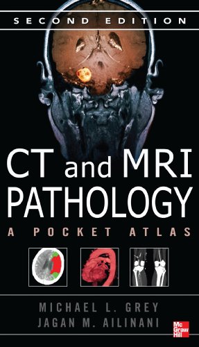 CT & MRI Pathology: A Pocket Atlas, Second Edition (9780071703192) by Grey, Michael; Ailinani, Jagan