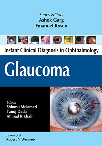 Stock image for Glaucoma (instant Clinical Diagnosis In Ophthalmology) for sale by Romtrade Corp.