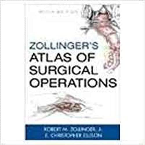 Stock image for Zollinger's Atlas of Surgical Operations 4 Stars! for sale by HPB-Red