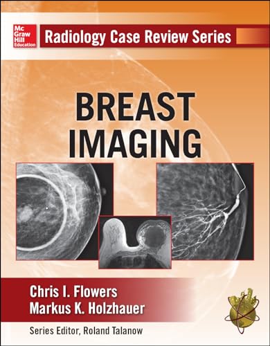 9780071787192: Radiology Case Review Series: Breast Imaging
