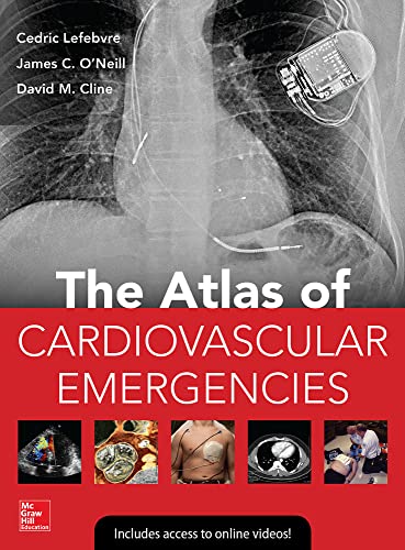 Stock image for Atlas of Cardiovascular Emergencies for sale by Books From California