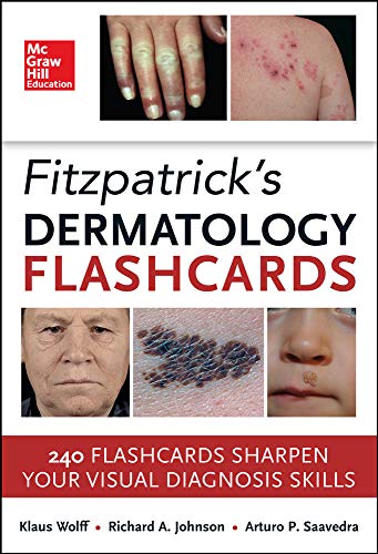 9780071794169: Fitzpatricks Dermatology Flash Cards