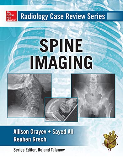 Stock image for Radiology Case Review Series: Spine for sale by BooksRun