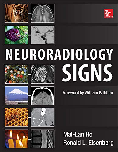 Imagen de archivo de Neuroradiology Signs a la venta por LibraryMercantile