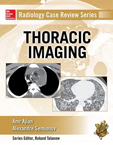 9780071818087: Radiology Case Review Series: Thoracic Imaging