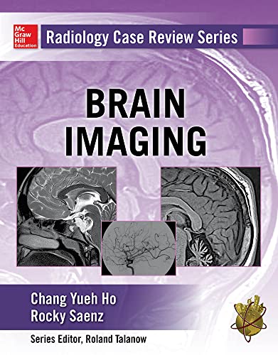 9780071826914: Radiology case review series: brain imaging (Medicina)