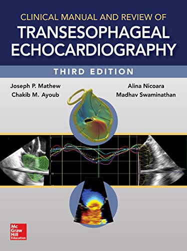 9780071830232: Clinical Manual and Review of Transesophageal Echocardiography, 3/e (MEDICAL/DENISTRY)