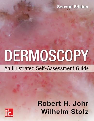 9780071834346: Dermoscopy: an illustrated self-assessment guide (Medicina)