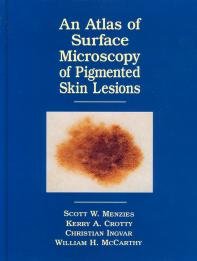 Beispielbild fr An Atlas of the Surface Microscopy of Pigmented Skin Tumors zum Verkauf von Pukkiware