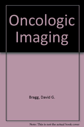 Oncologic Imaging (9780080336534) by David G. Bragg; Phillip Rubin; Hedvig Hricak