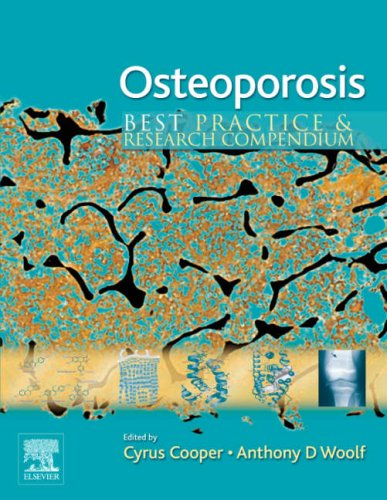 9780080446851: Osteoporosis: Best Practice & Research Compendium