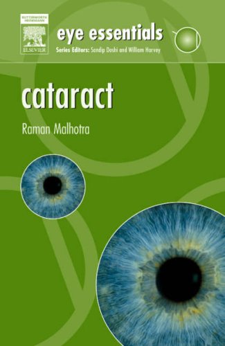 9780080449777: Cataract