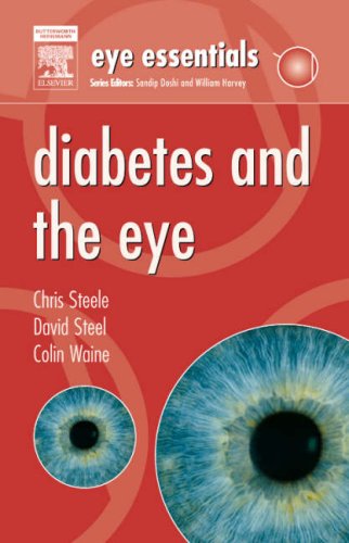 Beispielbild fr Diabetes and the Eye (Eye Essentials) zum Verkauf von WorldofBooks