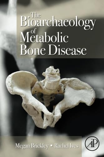 9780080975610: The Bioarchaeology of Metabolic Bone Disease