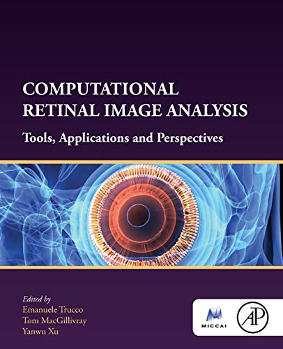 Stock image for Computational Retinal Image Analysis: Tools, Applications and Perspectives for sale by Brook Bookstore On Demand