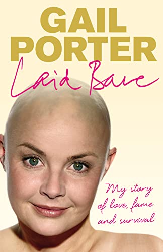 9780091920401: Laid Bare: My Story of Love, Fame and Survival