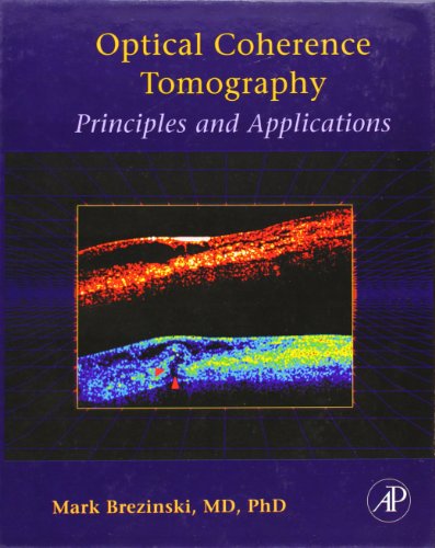 Stock image for Optical Coherence Tomography: Principles and Applications for sale by Chiron Media