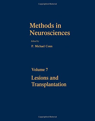 Beispielbild fr Methods in Neurosciences. Volume 7, Lesions and Transplantation zum Verkauf von Zubal-Books, Since 1961