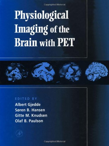 Stock image for Physiological Imaging of the Brain with PET for sale by HPB-Red