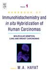 9780123339416: Immunohistochemistry and in Situ Hybridization of Human Carcinomas: Molecular Genetics Lung and Breast Carcinomas: 1