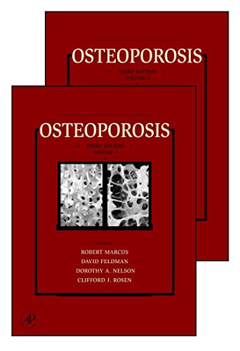 9780123705440: Osteoporosis 3E 2 Volume Set