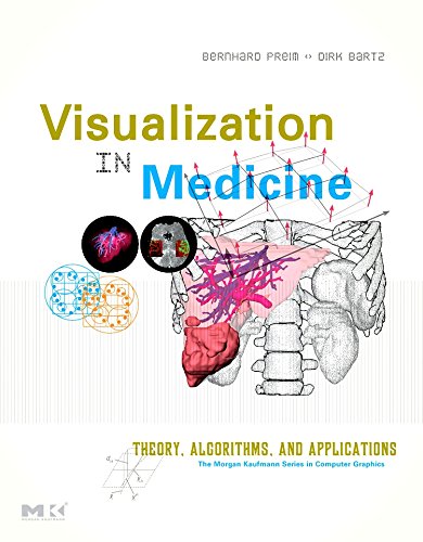 Visualization in Medicine: Theory, Algorithms, and Applications (The Morgan Kaufmann Series in Computer Graphics) (9780123705969) by Preim, Bernhard; Bartz, Dirk