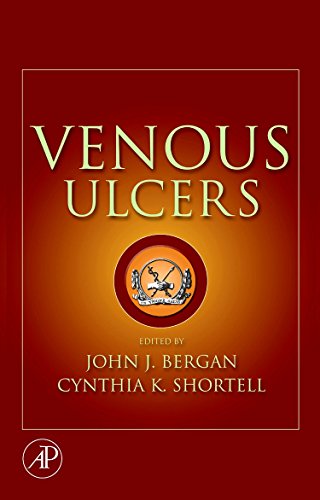 Stock image for Venous Ulcers for sale by Chiron Media