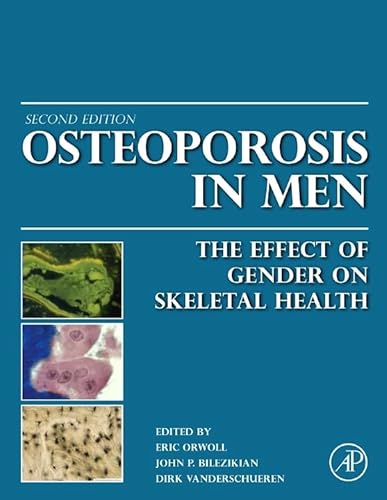 9780123746023: Osteoporosis in Men: The Effects of Gender on Skeletal Health