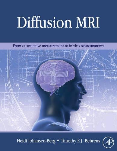 9780123747099: Diffusion MRI: From quantitative measurement to in-vivo neuroanatomy