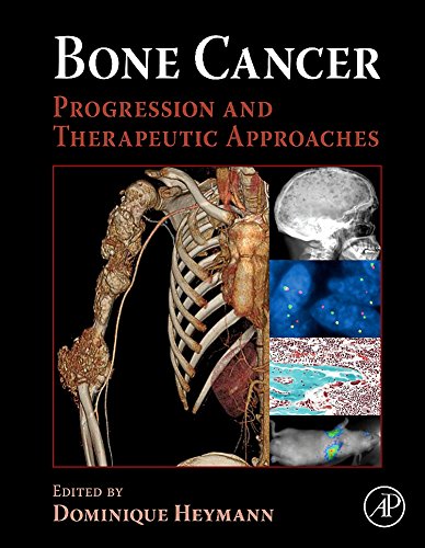 Stock image for Bone Cancer: Progression and Therapeutic Approaches for sale by Hay-on-Wye Booksellers