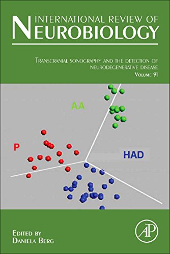 9780123813305: Transcranial Sonography in Movement Disorders: 90