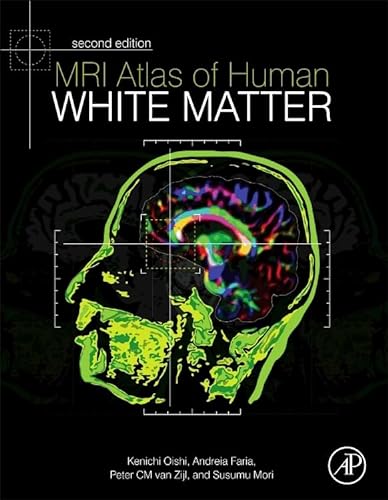 Stock image for MRI Atlas of Human White Matter for sale by Chiron Media
