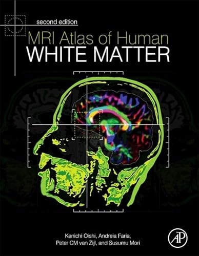 9780123820815: MRI Atlas of Human White Matter