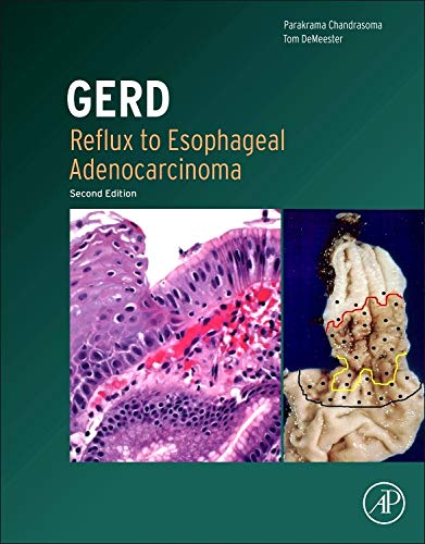 9780123945945: GERD: Reflux to Esophageal Adenocarcinoma
