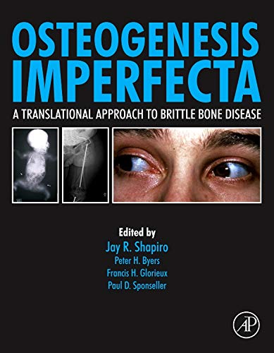 9780123971654: Osteogenesis Imperfecta: A Translational Approach to Brittle Bone Disease