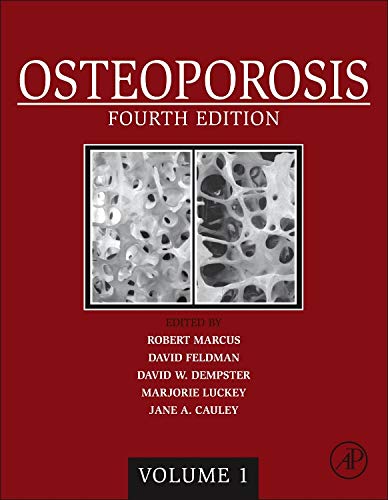 Beispielbild fr Osteoporosis zum Verkauf von Iridium_Books