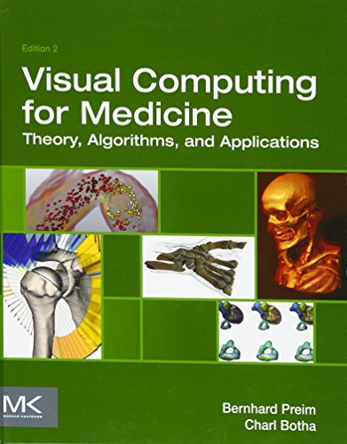 Stock image for Visual Computing for Medicine: Theory, Algorithms, and Applications (The Morgan Kaufmann Series in Computer Graphics) for sale by HPB-Red