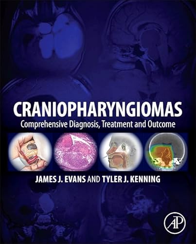 9780124167063: Craniopharyngiomas: Comprehensive Diagnosis, Treatment and Outcome