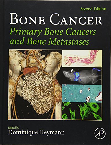 Imagen de archivo de Bone Cancer: Primary Bone Cancers and Bone Metastases a la venta por Chiron Media