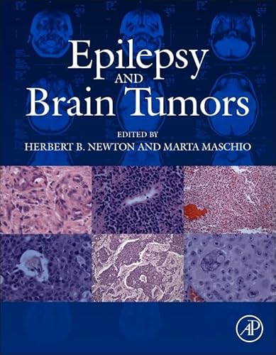 9780124170438: Epilepsy and Brain Tumors