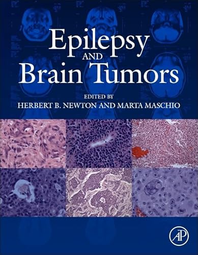 Stock image for Epilepsy and Brain Tumors for sale by Brook Bookstore On Demand