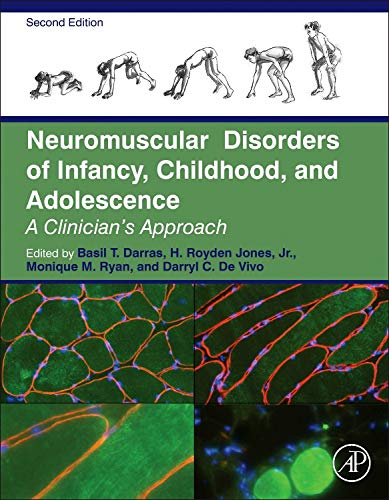 9780124170445: Neuromuscular Disorders of Infancy, Childhood, and Adolescence: A Clinician's Approach