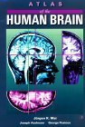 Stock image for Atlas of the Human Brain for sale by Books Puddle