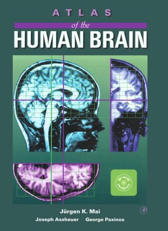 9780124653627: Atlas of the Human Brain