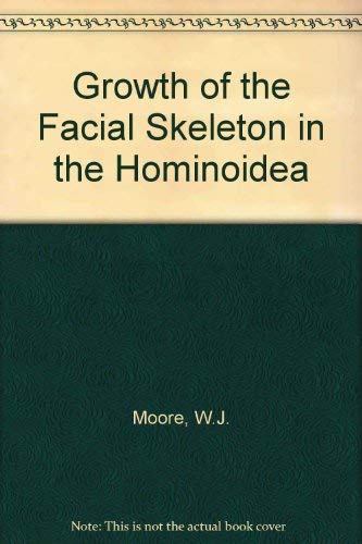 Growth of the Facial Skeleton in the Hominoidea