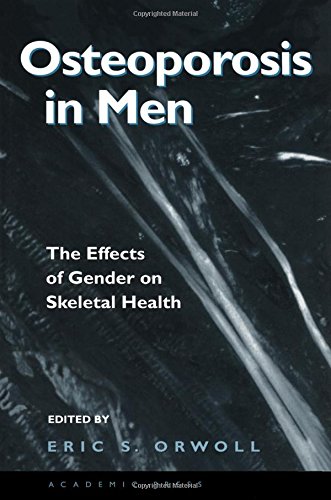 9780125286404: Osteoporosis in Men: The Effects of Gender on Skeletal Health